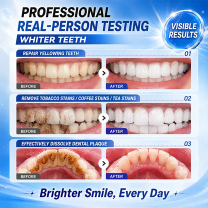 【Family Value Pack】Smileasego®Niacinamide Whitening Toothpaste for a Brighter, Fresher Smile