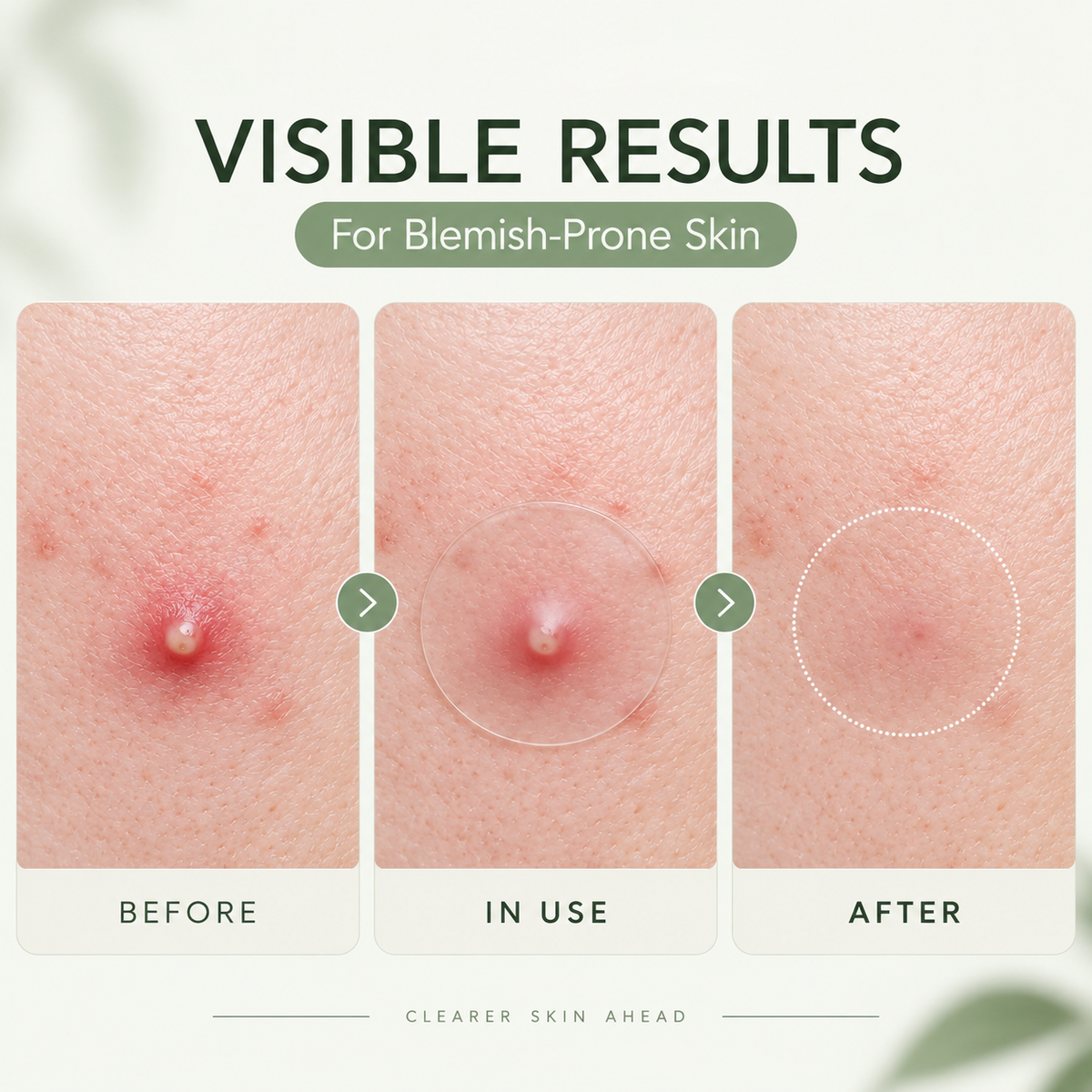 MEDAZY® 2-Step Blemish Patch Duo